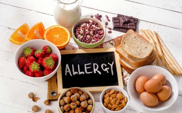 Food Allergies and Food Intolerance